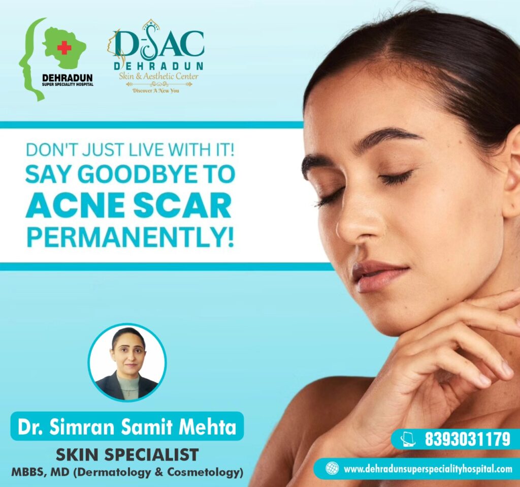 The Best Acne Scars Treatment by Dr. Simran Samit Mehta in Dehradun